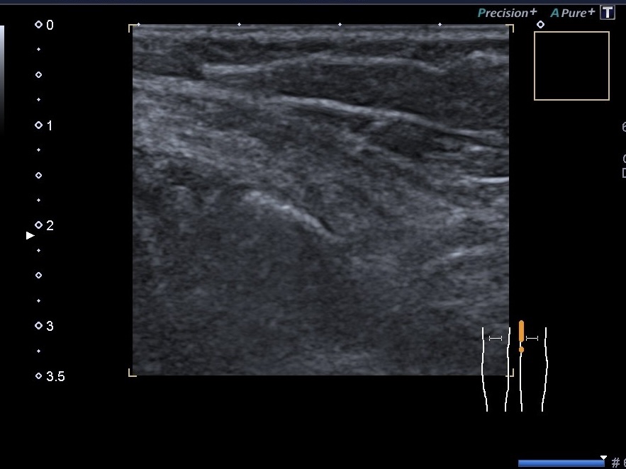 УЗД меніска Київ