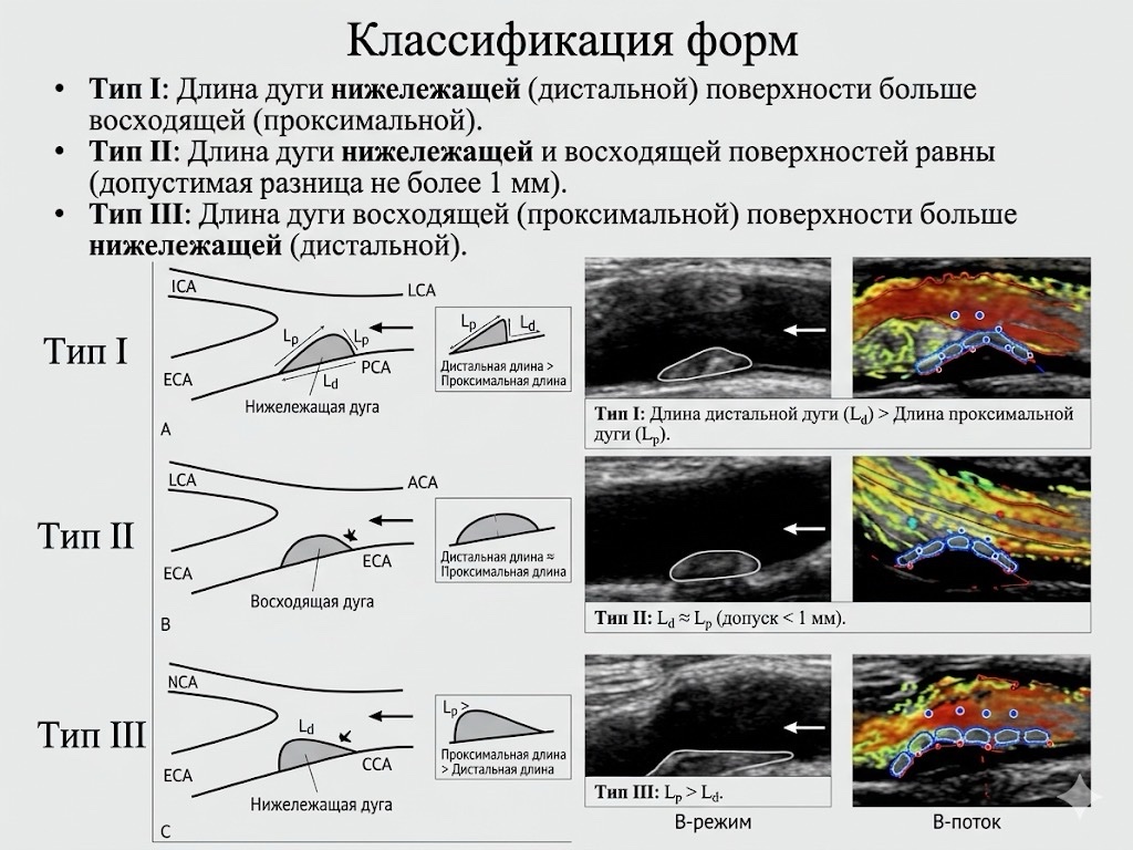  УЗИ сосудов шеи Киев